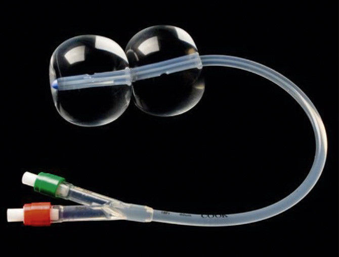 Disposable Cervical Dilation Balloon Medical Hospital Cervical Ripening